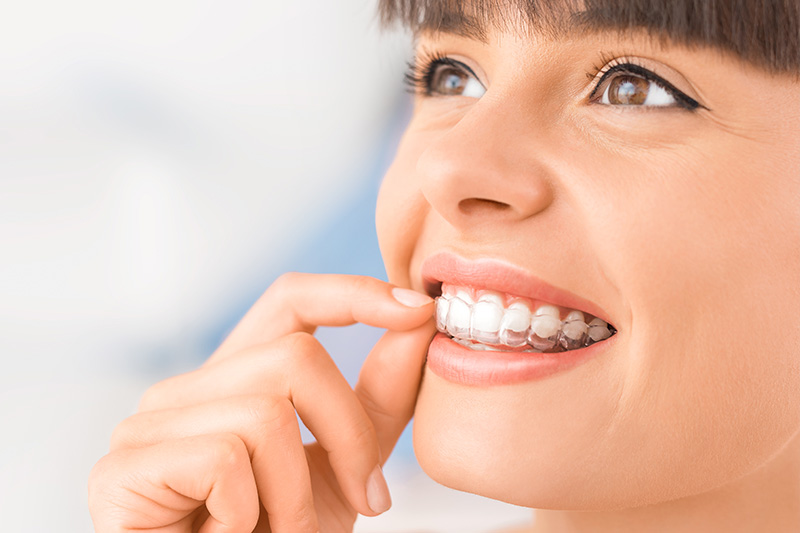 Clear Aligner Therapy in River Forest